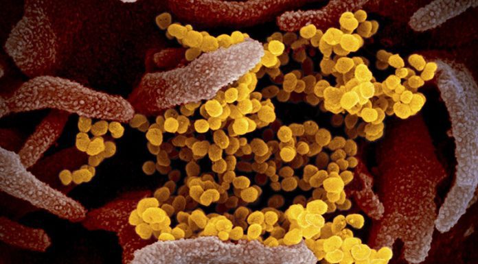 COVID-810: Viernes con 38 positivos, con 23 recuperados, 86 sospechados, con 206 menos contagios y 5 fallecidos perdidos