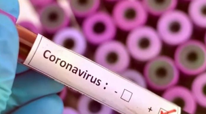 CORONAVIRUS: Ya con 500 zarateños atendidos, la cifra de infectados llegó a 57 y aparecieron 15 nuevos sospechados