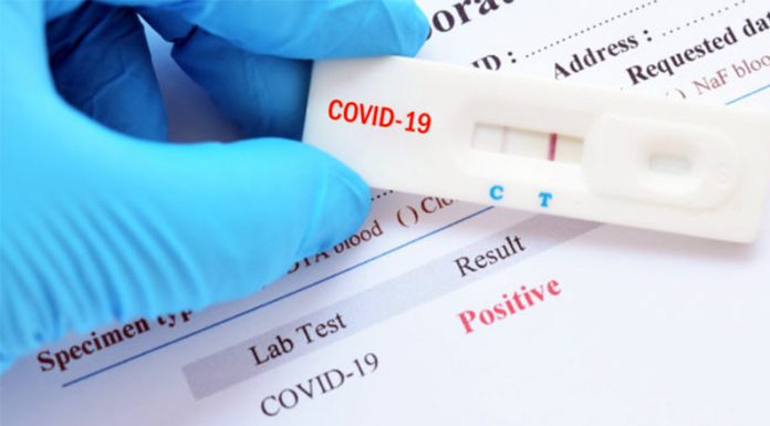 COVID-DÍA 204: Otras dos personas murieron hoy por Coronavirus y pasamos en un día el centenar de casos sospechados, 37 positivos y 39 recuperados