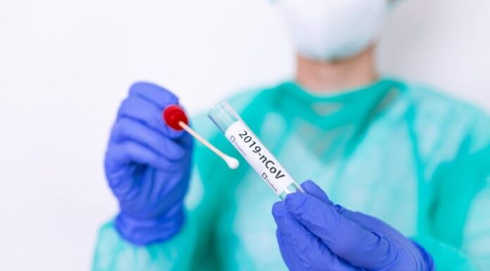 COVID-781: Crecen las diferencias oficiales en cantidad de casos no “encontrados”. Hoy con 4 positivos, 11 recuperados y 96 sospechados