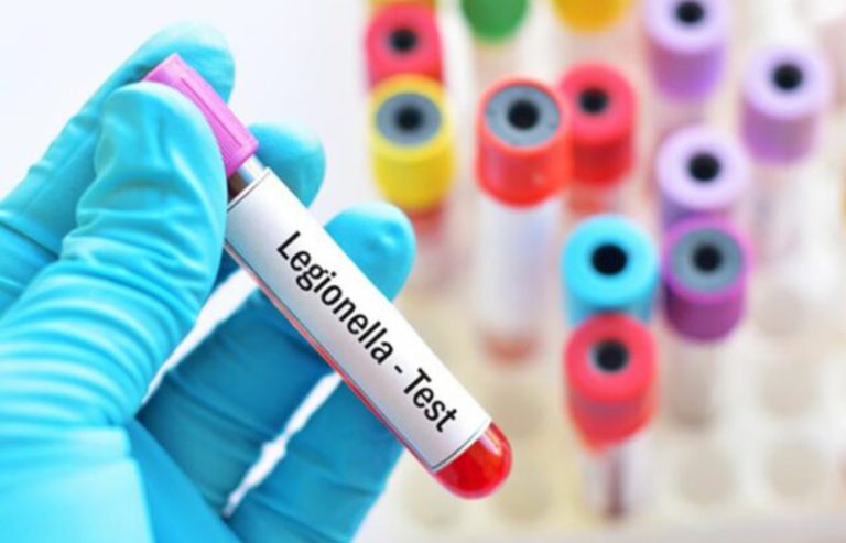 Neumonía de origen desconocido: ¿qué es la Legionella?