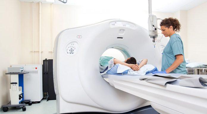 Por los controles postcovid, se diagnosticaron más tumores de pulmón en estadíos tempranos