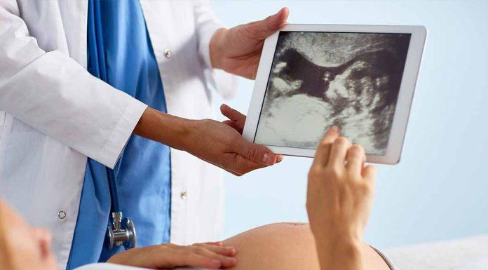 Hospital Alemán: Especialistas nos hablan del Día Internacional de la Espina Bífida que se recuerda cada 21 de noviembre