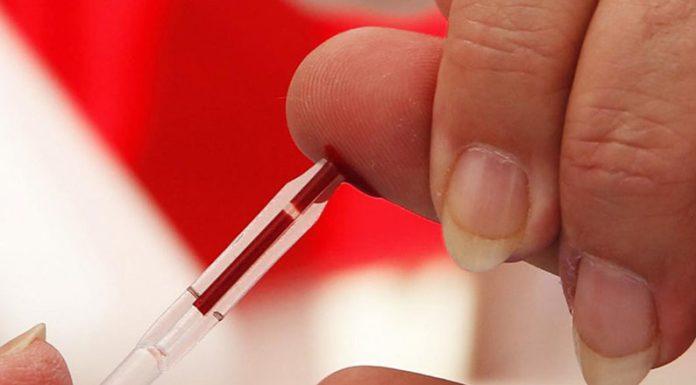 DÍA MUNDIAL: Más de 140 mil personas viven con VIH Sida en la Argentina y no descendió la mortalidad