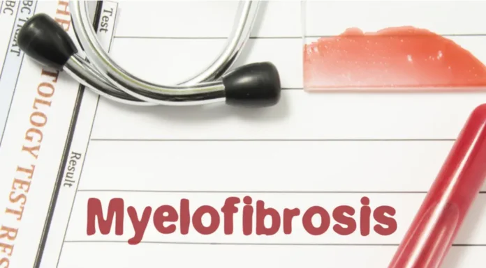 Mielofibrosis: una enfermedad rara y silenciosa que desestabiliza a la médula ósea en poco tiempo
