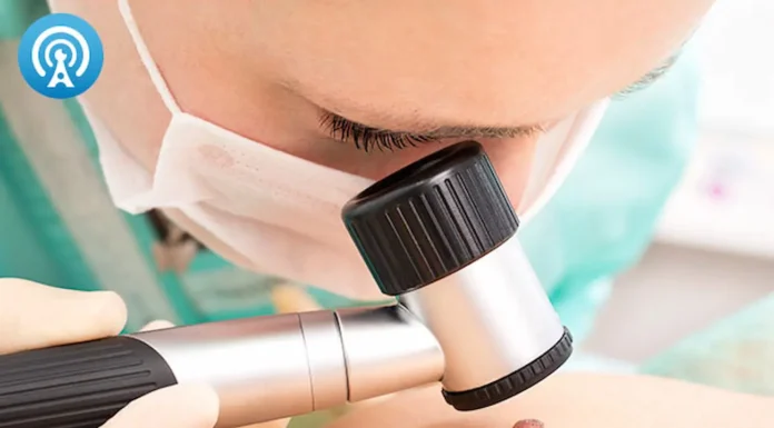 Día Mundial de la enfermedad Melanoma: un tumor agresivo que amenaza con convertirse en uno de los más frecuentes