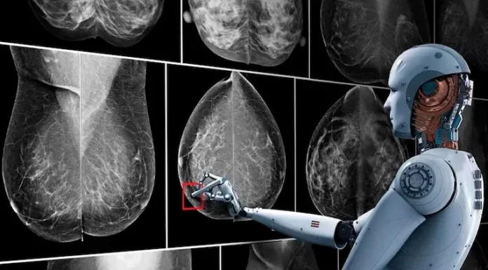 Cáncer de mama: crean un software con inteligencia artificial para identificarlo con mayor precisión