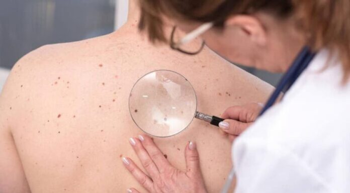 Cómo es la vacuna argentina contra el cáncer de piel más grave