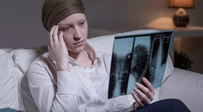 Crecen los casos y la mortalidad por cáncer de pulmón entre las mujeres