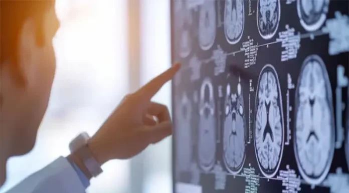 Día de los Derechos de las Personas con Epilepsia: Educación, trabajo y acceso a los tratamientos, los derechos más vulnerados de las personas con epilepsia