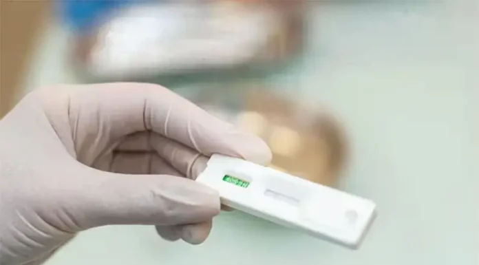 Avance para mejorar los diagnósticos de VIH: cómo funciona el primer autotest disponible en Argentina