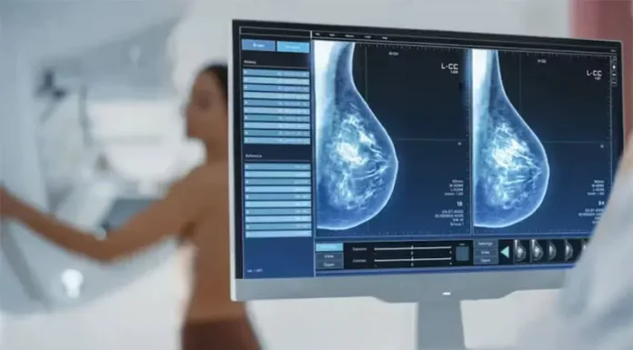 Nuevos fármacos basados en metales, una de las claves en los avances para el tratamiento de cáncer de mama