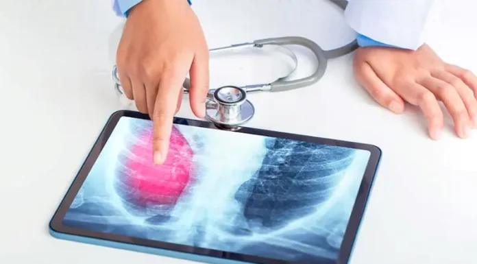 Crearon un dispositivo experimental que busca indicios del cáncer de pulmón en el aliento