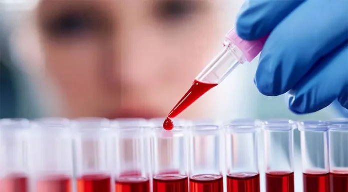 El científico argentino que junto a un equipo de Oxford logró un hito en la investigación del cáncer de sangre