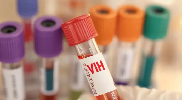 Día Mundial del VIH: en América Latina las infecciones aumentaron 9% desde 2010