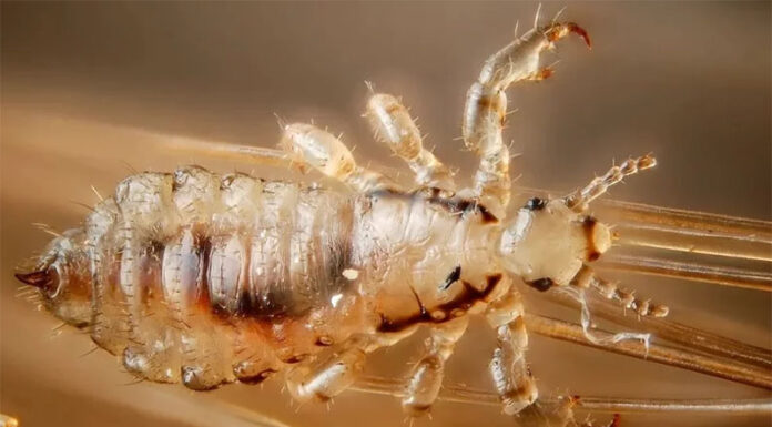 ESTUDIO INTERNACIONAL: Los piojos que recorrieron el mundo para contar la historia de la humanidad