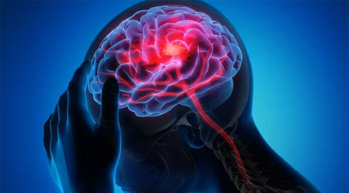 Cada minuto cuenta: reconocer los síntomas de un ACV y actuar a tiempo puede salvar vidas