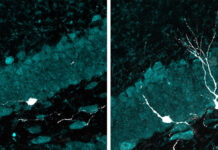 La estimulación con luz y sonido intermitentes promueve el desarrollo de nuevas neuronas en cerebros envejecidos