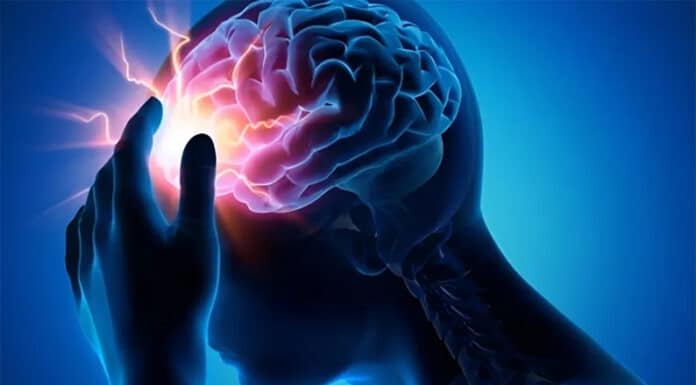 Concientización de la Epilepsia: los beneficios de la terapia cetogénica