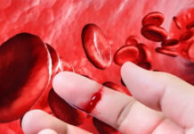 La Anmat aprobó un nuevo tratamiento contra la hemofilia: en qué consiste y cuáles son sus ventajas