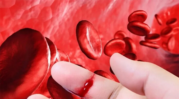 La Anmat aprobó un nuevo tratamiento contra la hemofilia: en qué consiste y cuáles son sus ventajas