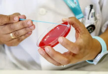 La sífilis acecha: en 2025 se notificaron 46.799 casos en el país