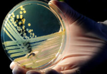 Sugieren tratar “superbacterias” con un virus que las ataca en combinación con antibióticos