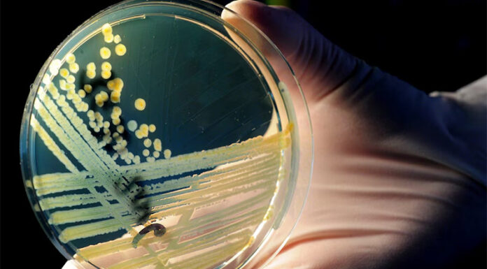 Sugieren tratar “superbacterias” con un virus que las ataca en combinación con antibióticos