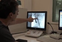 Cirugía inédita: por primera vez, colocaron un stent bioabsorbible en un bebé prematuro