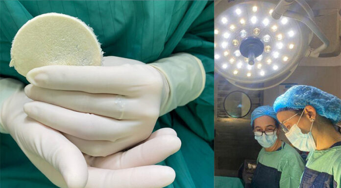 Con parches de placenta humana, logran cicatrizar una herida compleja